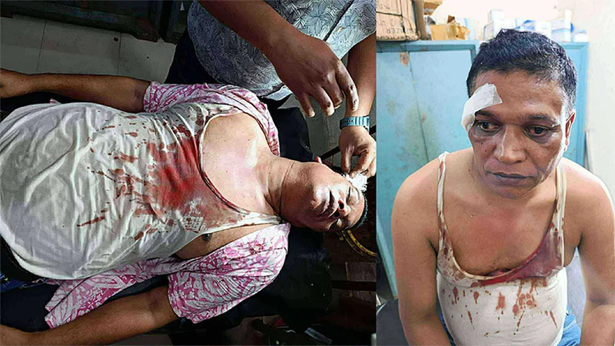 Journalist Brutally Attacked During Puja in Sitakunda Over Alleged Awami League Ties