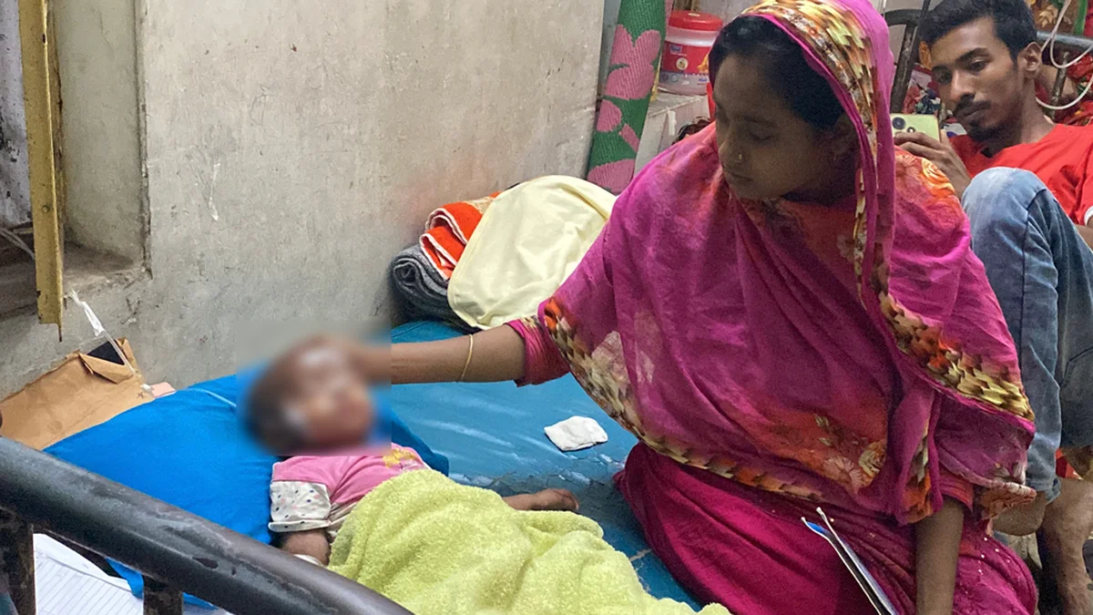 19 Child Deaths in Dhaka as Measles Cases Spike